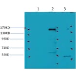 Western blot - ErbB-2/HER-2 Mouse Monoclonal Antibody from Signalway Antibody (38036) - Antibodies.com