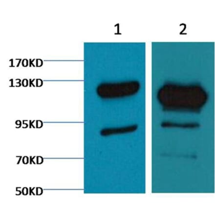 Western blot - Cleaved PARP Mouse Monoclonal Antibody from Signalway Antibody (38068) - Antibodies.com