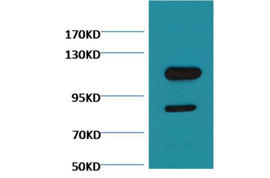 Western blot - Cleaved PARP Mouse Monoclonal Antibody from Signalway Antibody (38076) - Antibodies.com