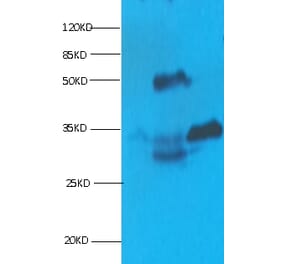 Cardiac Troponin I Monoclonal Antibody from Signalway Antibody (42040) - Antibodies.com