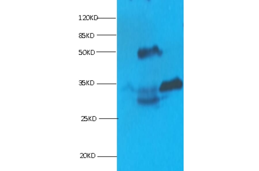 Cardiac Troponin I Monoclonal Antibody from Signalway Antibody (42040) - Antibodies.com