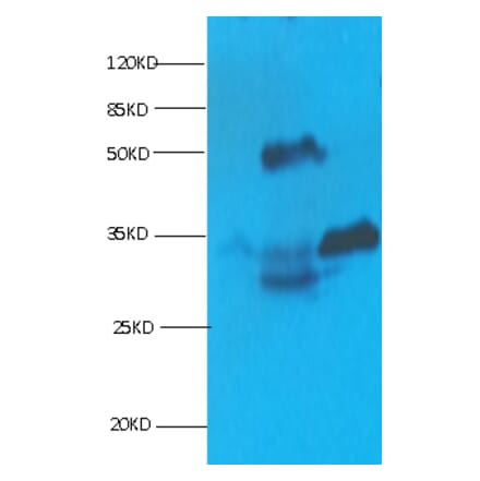 Cardiac Troponin I Monoclonal Antibody from Signalway Antibody (42040) - Antibodies.com