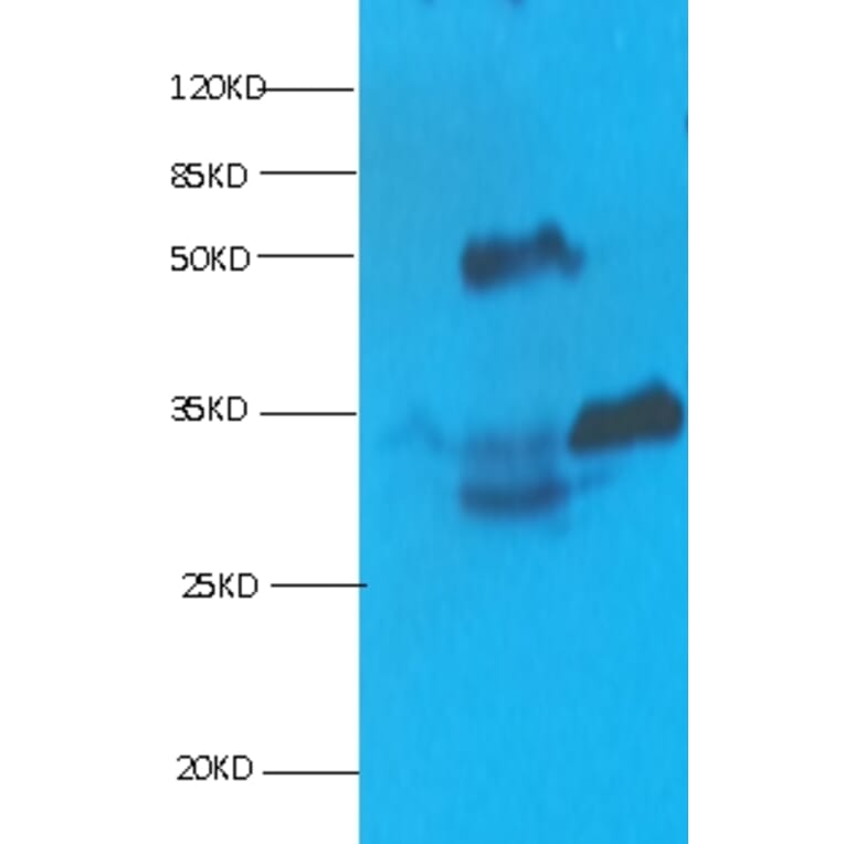 Cardiac Troponin I Monoclonal Antibody from Signalway Antibody (42040) - Antibodies.com