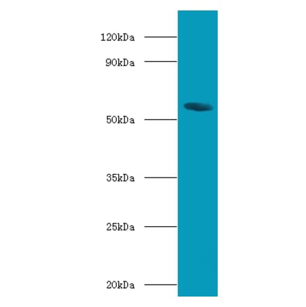 Bile acid receptor Polyclonal Antibody from Signalway Antibody (42665) - Antibodies.com