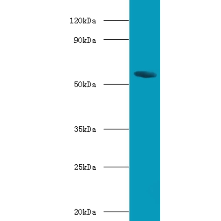 Bile acid receptor Polyclonal Antibody from Signalway Antibody (42665) - Antibodies.com