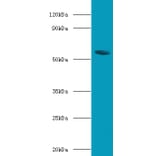 Bile acid receptor Polyclonal Antibody from Signalway Antibody (42665) - Antibodies.com