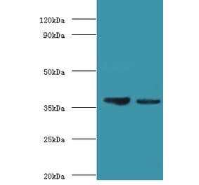 Aldose 1-epimerase Polyclonal Antibody from Signalway Antibody (42669) - Antibodies.com