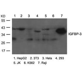Western blot - IGFBP-3 Antibody from Signalway Antibody (21671) - Antibodies.com