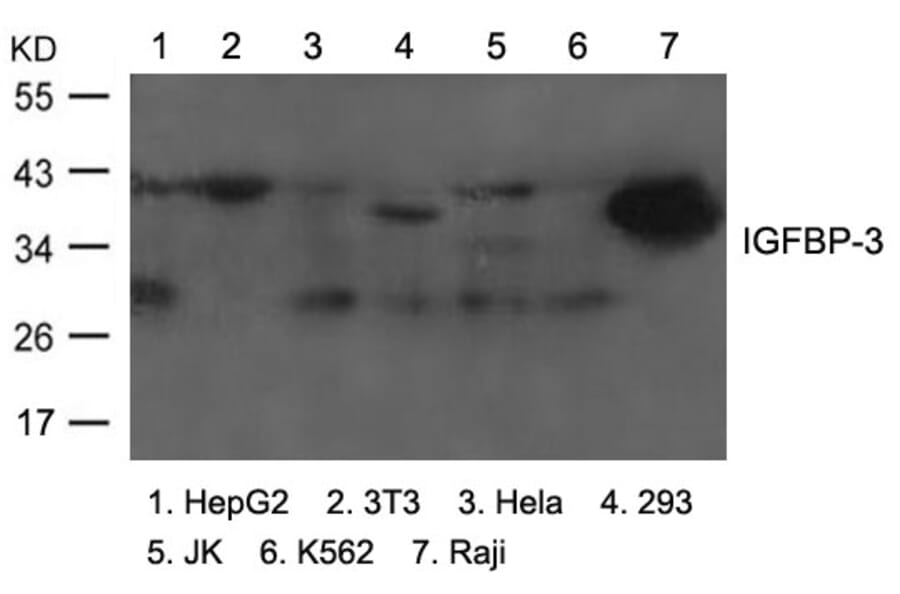 Western blot - IGFBP-3 Antibody from Signalway Antibody (21671) - Antibodies.com