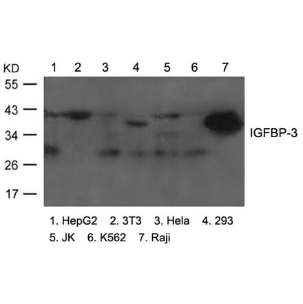 Western blot - IGFBP-3 Antibody from Signalway Antibody (21671) - Antibodies.com