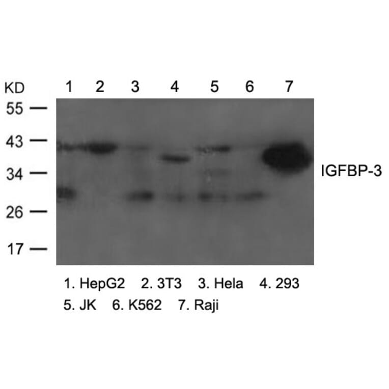 Western blot - IGFBP-3 Antibody from Signalway Antibody (21671) - Antibodies.com