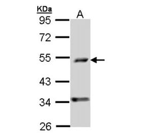 C6orf210 antibody from Signalway Antibody (22198) - Antibodies.com