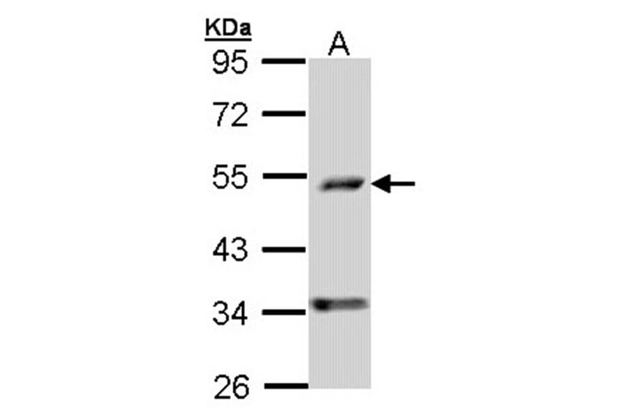 C6orf210 antibody from Signalway Antibody (22198) - Antibodies.com