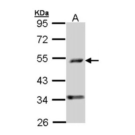 C6orf210 antibody from Signalway Antibody (22198) - Antibodies.com