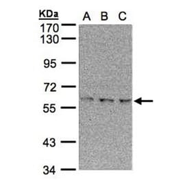 EPM2AIP1 antibody from Signalway Antibody (22387) - Antibodies.com