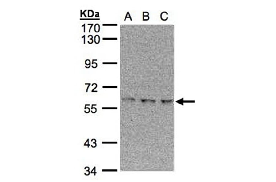 EPM2AIP1 antibody from Signalway Antibody (22387) - Antibodies.com