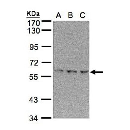 EPM2AIP1 antibody from Signalway Antibody (22387) - Antibodies.com