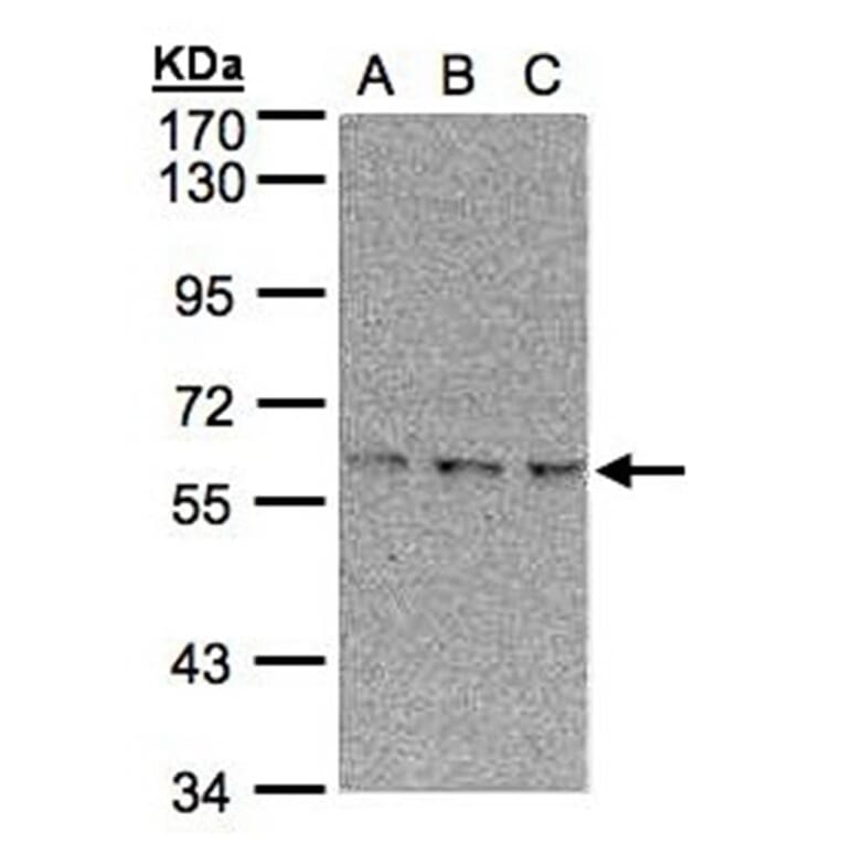 EPM2AIP1 antibody from Signalway Antibody (22387) - Antibodies.com