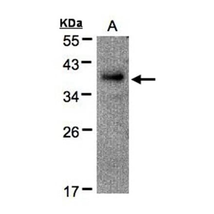 RAD51AP1 antibody from Signalway Antibody (22444) - Antibodies.com