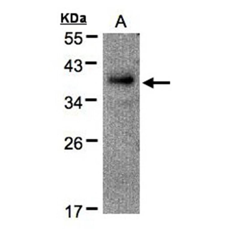 RAD51AP1 antibody from Signalway Antibody (22444) - Antibodies.com