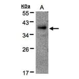 RAD51AP1 antibody from Signalway Antibody (22444) - Antibodies.com