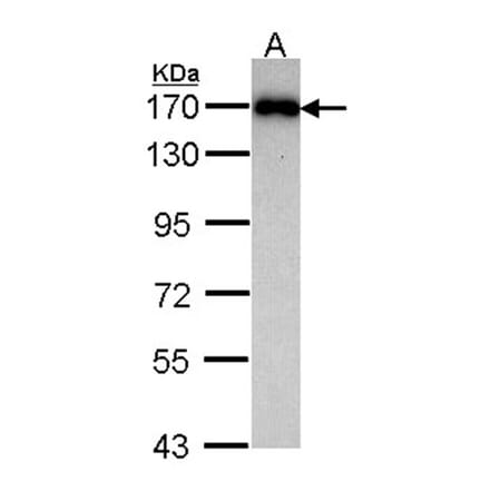 MAGI-2 antibody from Signalway Antibody (22734) - Antibodies.com