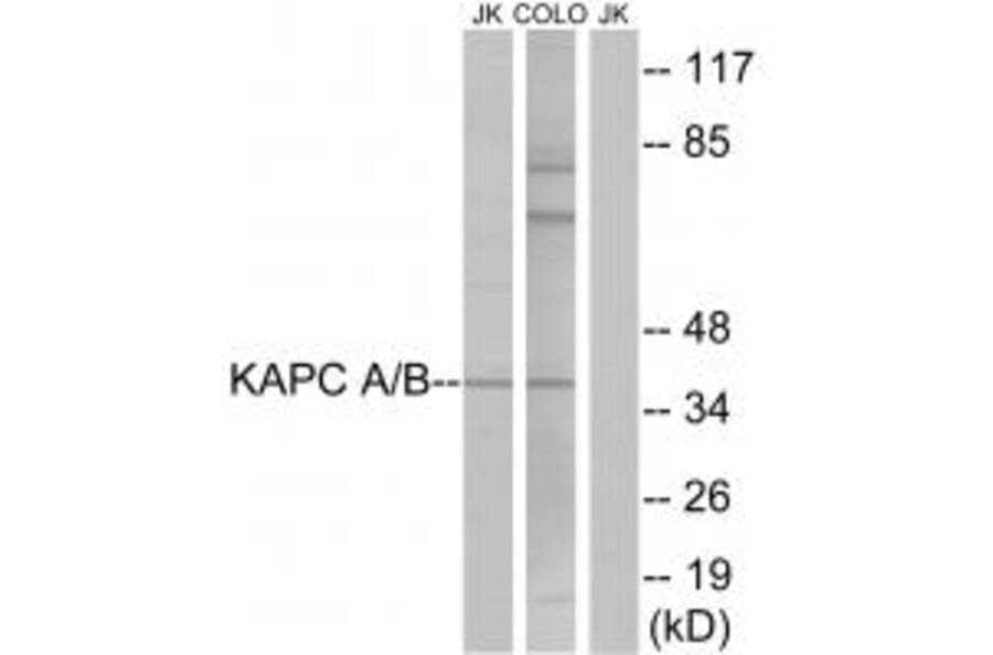 Western blot - KAPC A/B Antibody from Signalway Antibody (33696) - Antibodies.com