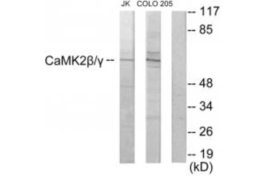 Western blot - CaMK2β/γ Antibody from Signalway Antibody (33871) - Antibodies.com