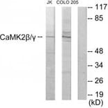 Western blot - CaMK2β/γ Antibody from Signalway Antibody (33871) - Antibodies.com