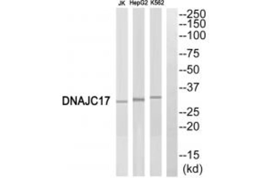Western blot - DNAJC17 Antibody from Signalway Antibody (34080) - Antibodies.com