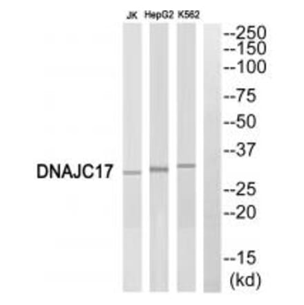 Western blot - DNAJC17 Antibody from Signalway Antibody (34080) - Antibodies.com