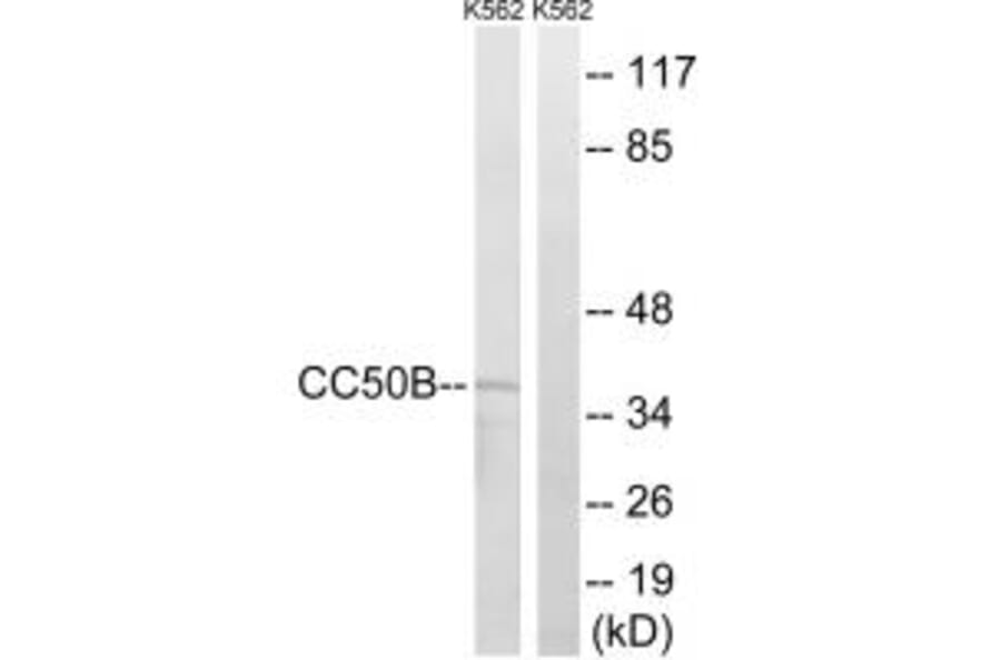 Western blot - TMEM30B Antibody from Signalway Antibody (34185) - Antibodies.com