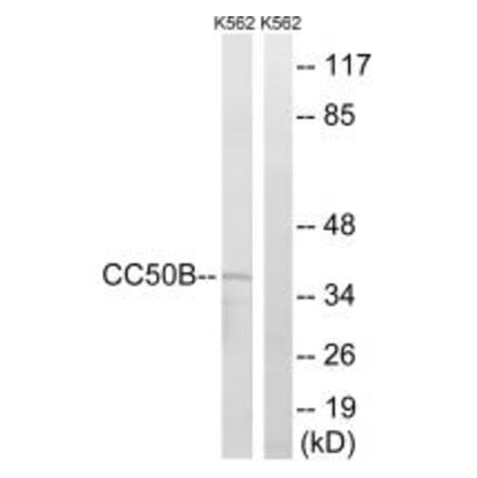 Western blot - TMEM30B Antibody from Signalway Antibody (34185) - Antibodies.com