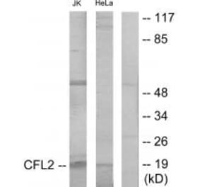 Western blot - Cofilin Antibody from Signalway Antibody (34215) - Antibodies.com