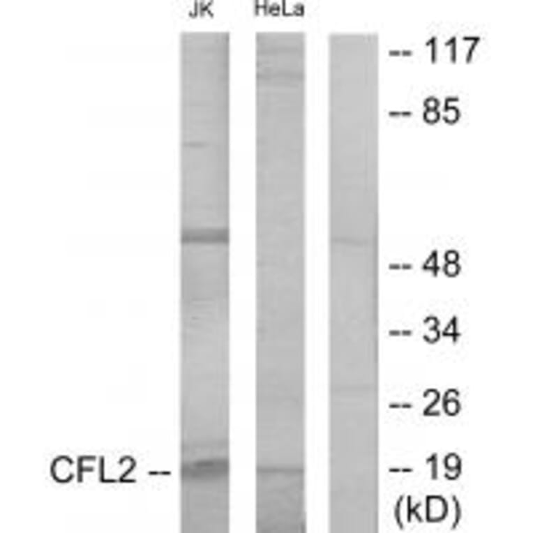 Western blot - Cofilin Antibody from Signalway Antibody (34215) - Antibodies.com