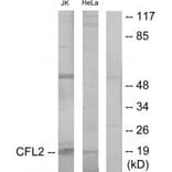 Western blot - Cofilin Antibody from Signalway Antibody (34215) - Antibodies.com