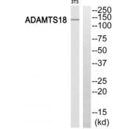 Western blot - ADAMTS18 Antibody from Signalway Antibody (34387) - Antibodies.com