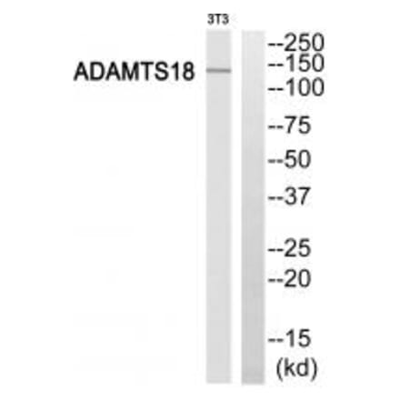 Western blot - ADAMTS18 Antibody from Signalway Antibody (34387) - Antibodies.com