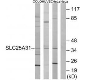 Western blot - SLC25A31 Antibody from Signalway Antibody (34389) - Antibodies.com