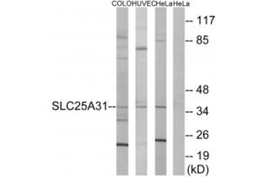 Western blot - SLC25A31 Antibody from Signalway Antibody (34389) - Antibodies.com