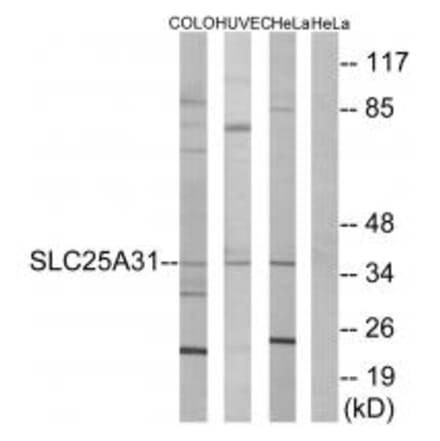 Western blot - SLC25A31 Antibody from Signalway Antibody (34389) - Antibodies.com