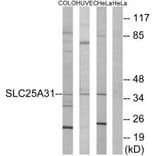Western blot - SLC25A31 Antibody from Signalway Antibody (34389) - Antibodies.com