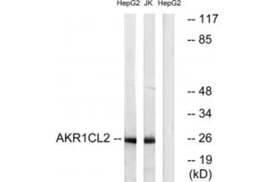 Western blot - AKR1CL2 Antibody from Signalway Antibody (34402) - Antibodies.com