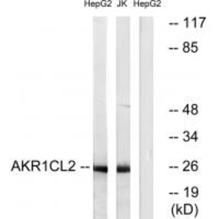 Western blot - AKR1CL2 Antibody from Signalway Antibody (34402) - Antibodies.com