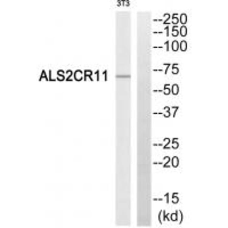 Western blot - ALS2CR11 Antibody from Signalway Antibody (34416) - Antibodies.com