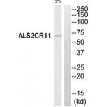 Western blot - ALS2CR11 Antibody from Signalway Antibody (34416) - Antibodies.com