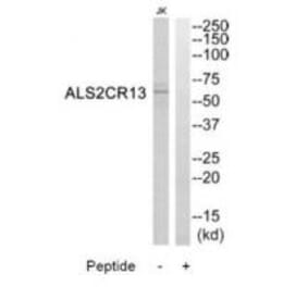 Western blot - ALS2CR13 Antibody from Signalway Antibody (34419) - Antibodies.com