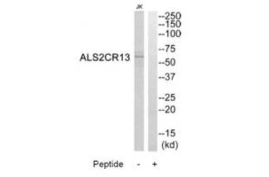 Western blot - ALS2CR13 Antibody from Signalway Antibody (34419) - Antibodies.com