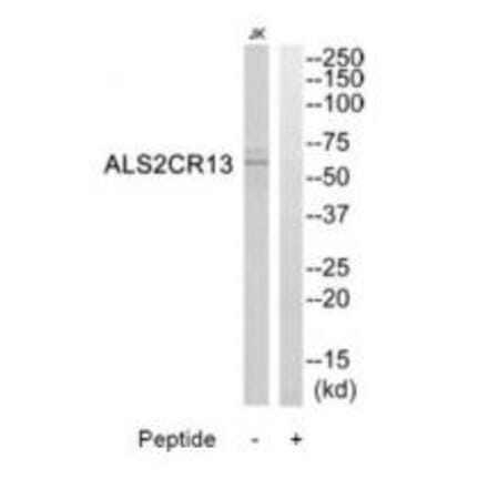 Western blot - ALS2CR13 Antibody from Signalway Antibody (34419) - Antibodies.com