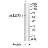 Western blot - ALS2CR13 Antibody from Signalway Antibody (34419) - Antibodies.com